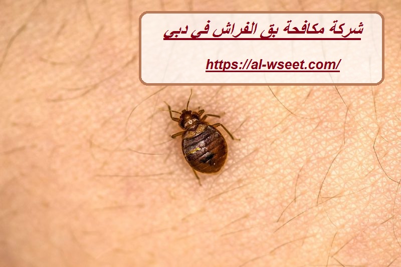 شركة مكافحة بق الفراش في دبي